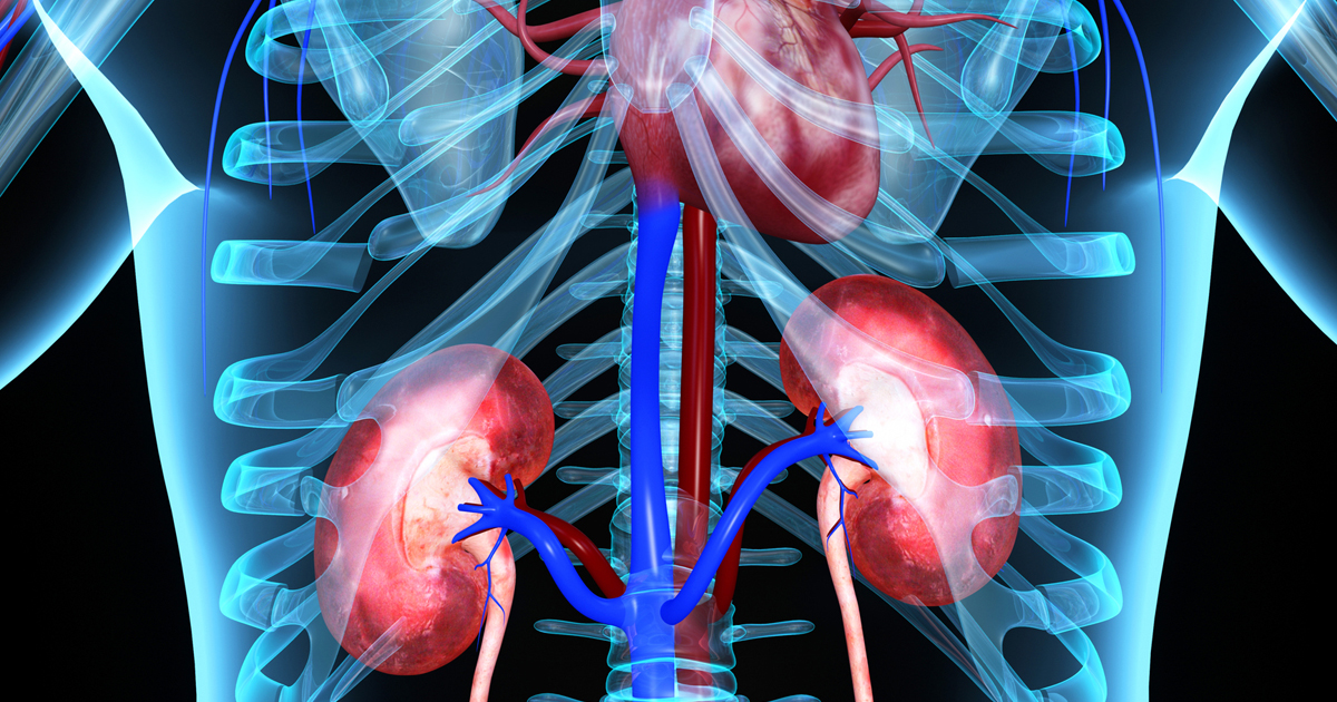 Bladder, Kidney & Ureteral Stones | El Camino Health