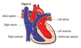 Heart Fig A