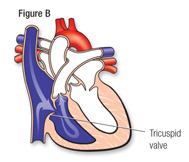 Heart Fig B