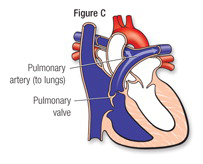 Heart Fig C