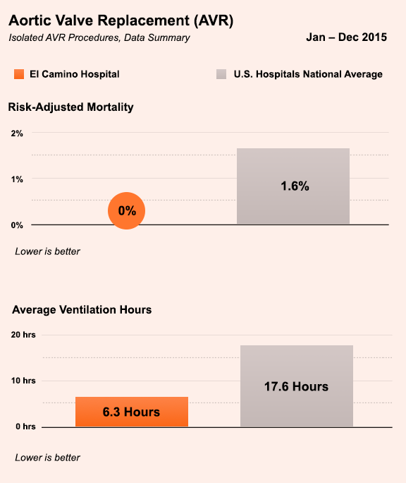 Aortic Valve Replacement Surgery Aortic Valve Replacement Surgery