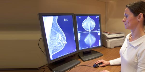 Breast Density