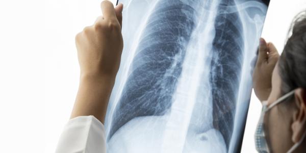 Healthy Lungs