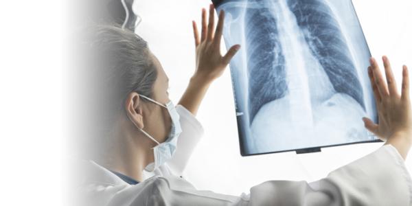 Lung Cancer Screening Lung Cancer Screening