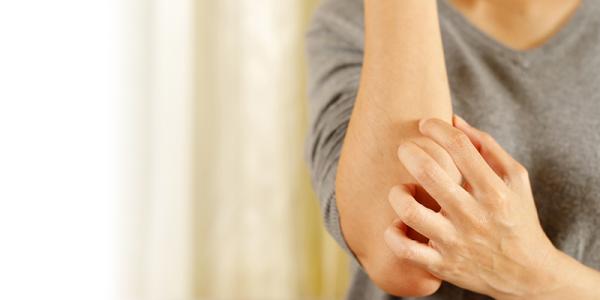 Person Scratching Arm Due to Psoriasis Person Scratching Arm Due to Psoriasis