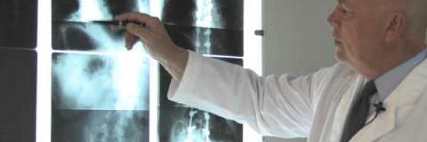 Scoliosis Treatment Options for Children and Adults 