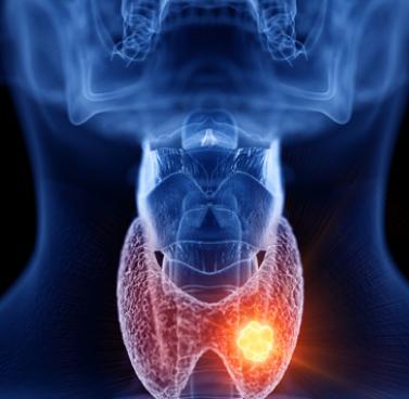 What You Should Know About Thyroid Health