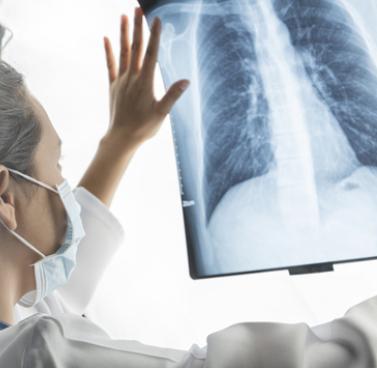 Lung Cancer Screening