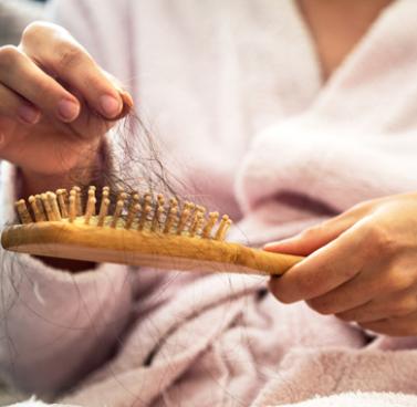 Dealing With Hair Loss