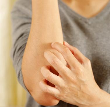 Person Scratching Arm Due to Psoriasis